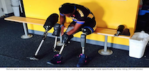 Athlete Putting Prosthetic Legs On