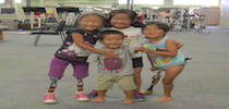 Group Of Children With Prosthetic Legs