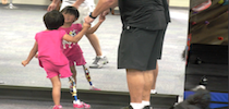 Young Girl With Prosthetic Leg Looking In Mirror