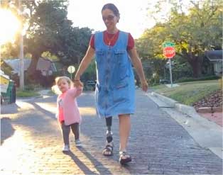 Woman With Prosthetic Leg Walking With Young Child